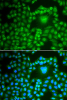 PPP1CB Antibody