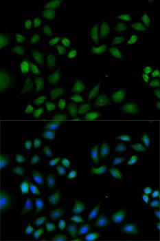 PRDX1 Antibody
