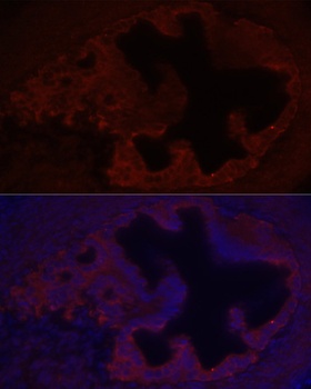 COL1A1 Antibody