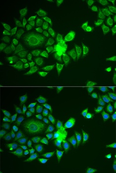 NDUFS4 Antibody