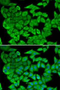 MDH2 Antibody
