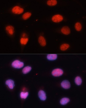 MCM5 Antibody
