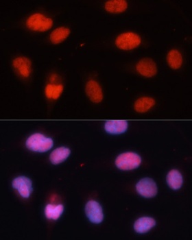 MCM5 Antibody