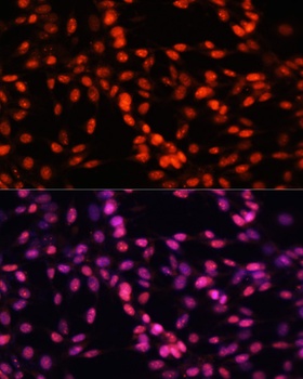 MCM5 Antibody