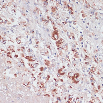 LYZ Antibody