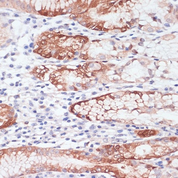 LYZ Antibody