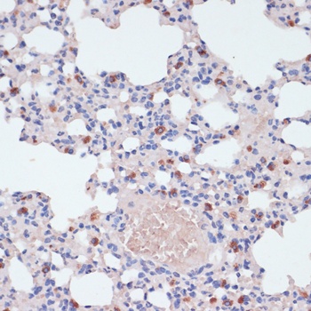 LYZ Antibody