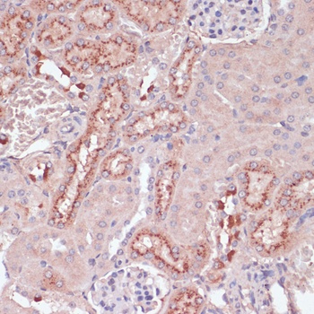 LYZ Antibody