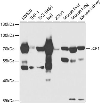 LCP1 Antibody