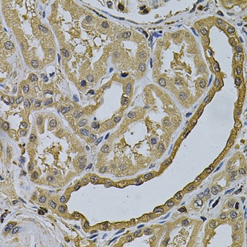 LCP1 Antibody