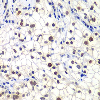 GTF2F2 Antibody