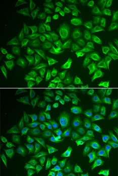 EHHADH Antibody