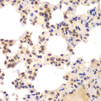 CSNK2A2 Antibody