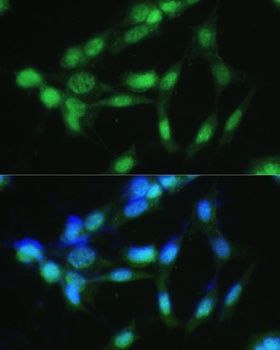 CSNK2A2 Antibody