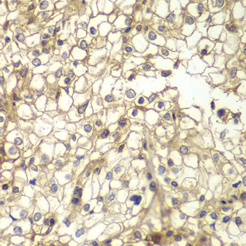 CD1D Antibody