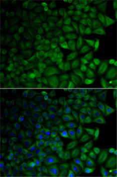 CD1D Antibody