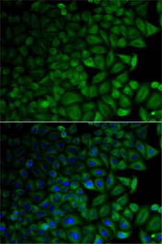 CD1D Antibody