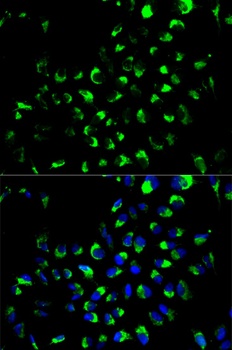 AK4 Antibody