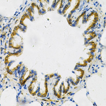 AK1 Antibody