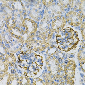 AK1 Antibody