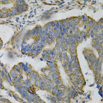 AK1 Antibody