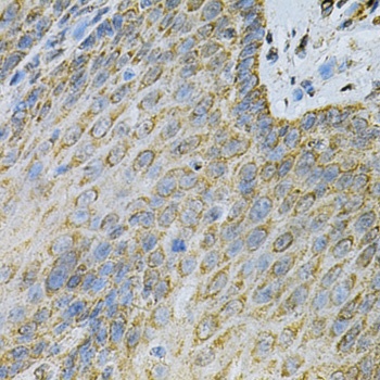 AK1 Antibody