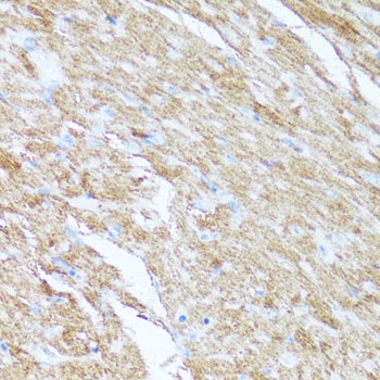 AK1 Antibody