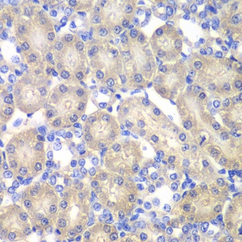 ACY1 Antibody