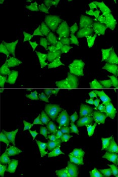 ACY1 Antibody