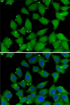 RBBP7 Antibody