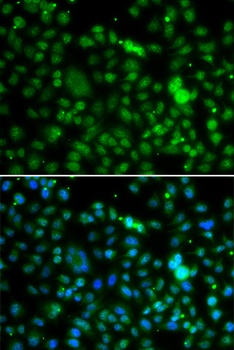 NSUN6 Antibody