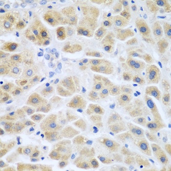 ACCS Antibody