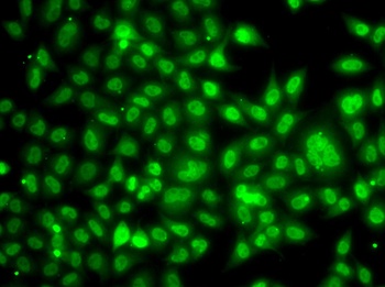 TBL1XR1 Antibody