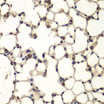 PHF11 Antibody