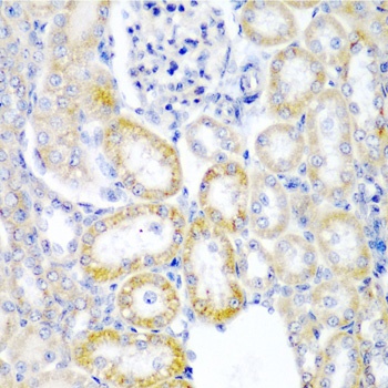 UPF2 Antibody