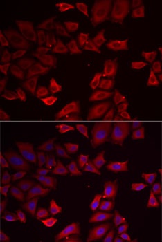 SEPHS1 Antibody