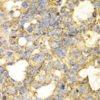 SOD2 Antibody