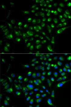SOD2 Antibody
