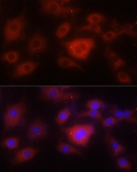 SOD2 Antibody