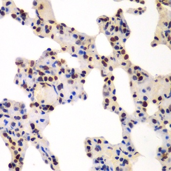 GNB2L1 Antibody