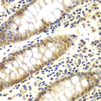 GNB2L1 Antibody