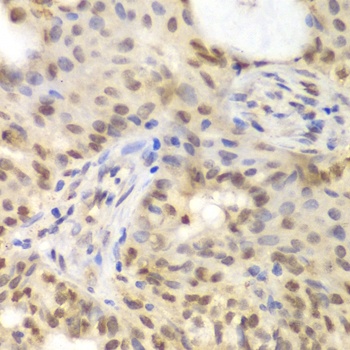 GNB2L1 Antibody