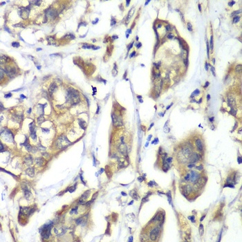 NFS1 Antibody