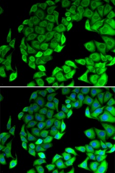 RPL14 Antibody