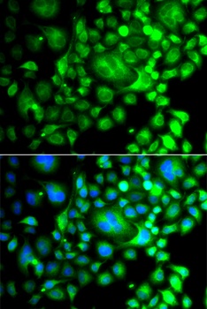 SNX3 Antibody