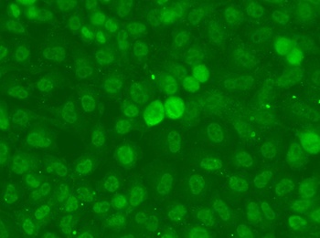 SSNA1 Antibody