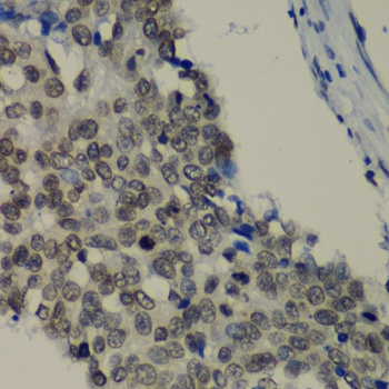 TEAD1 Antibody