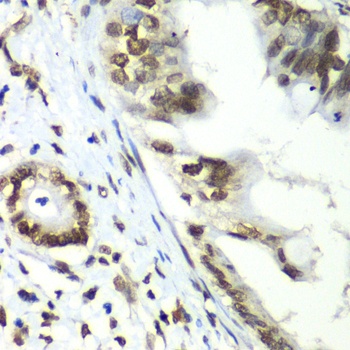 TEAD1 Antibody