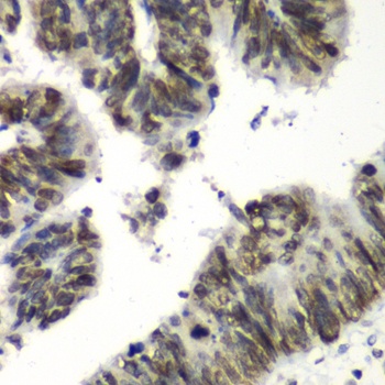 TEAD1 Antibody