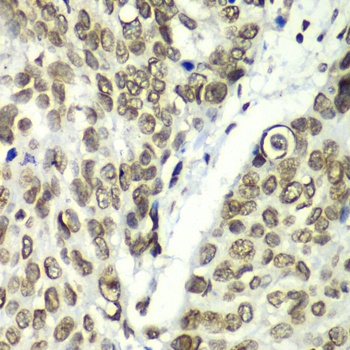 TEAD1 Antibody